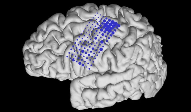 BCI. Técnicas semi-invasivas